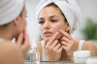 Does Salicylic Acid Cause Purging?