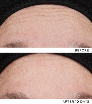 The Exceptional RetiNAD+ Renewal Booster Refill 10 Doses