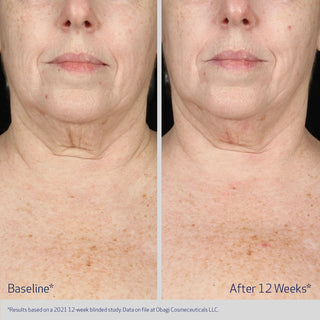 Elastiderm Neck And Decollete Concentrate 60ml