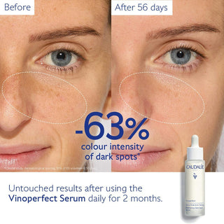 Vinoperfect Brightening Dark Spot Serum 50ml