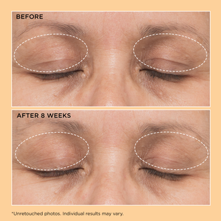 Neuropeptide Eyelid Lift Serum 15ml