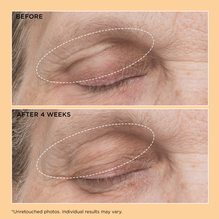 Neuropeptide Eyelid Lift Serum 15ml