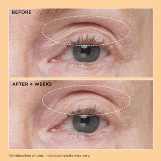 Neuropeptide Eyelid Lift Serum 15ml