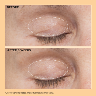 Neuropeptide Eyelid Lift Serum 15ml