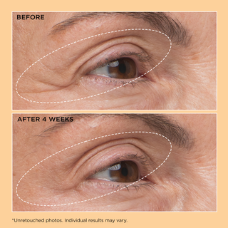 Neuropeptide Eyelid Lift Serum 15ml