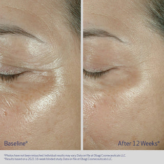 Elastiderm Eye Cream 15g