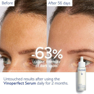 Vinoperfect Brightening Dark Spot Serum 50ml