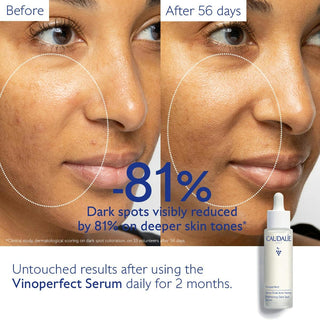 Vinoperfect Brightening Dark Spot Serum 50ml