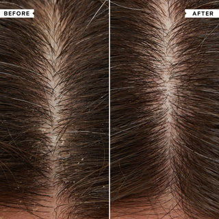 Flaky Itchy Scalp Hydrating Conditioner 200ml