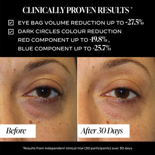 Triple Action Eye Cream 15ml