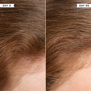 Density Preserving Scalp Drops 85ml