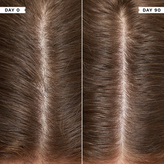 Density Preserving Scalp Drops 85ml