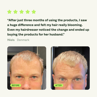 Bio-Pilixon Hairline Booster 15ml