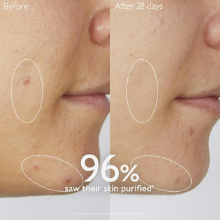 Vinopure Purifying Gel Cleanser 75ml