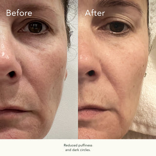 Rose Hip Intense Recovery Eye Serum 15ml