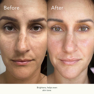 Biocell Correcting Serum 30ml