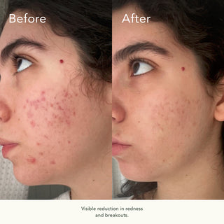 Vitabiome Active Skin Optimizer 100ml