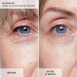 Aqua Infusion: Daily Skin Awakening Set