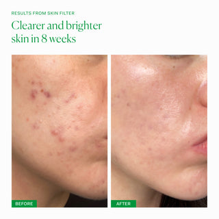 Skin Filter 30 capsules