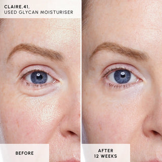 Aqua Infusion: Daily Skin Awakening Set