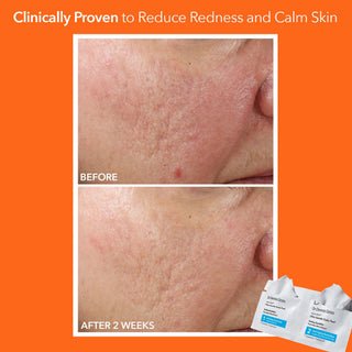 Alpha Beta Ultra Gentle Daily Peel 30 doses