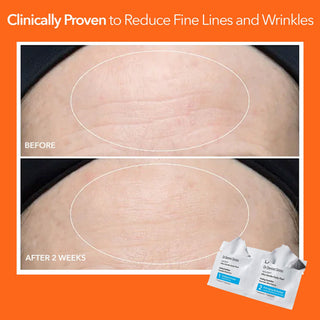 Alpha Beta Ultra Gentle Daily Peel 5 doses