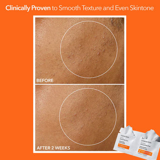 Alpha Beta Universal Peel 60 doses
