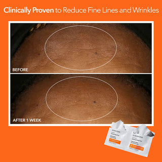 Alpha Beta Universal Peel 5 doses