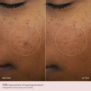 Micro-Peeling Glow Essence 100ml