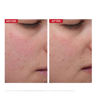 Freezing Anti-Fatigue Mask Free Gift