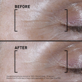 Time-Filler Shot 5Xp Concentrated Serum Visible Expression Lines Correction 15ml