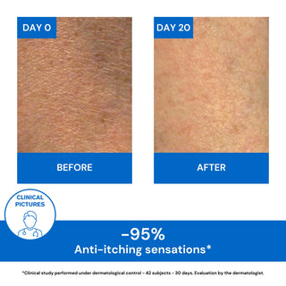 Xémose Lipid-Replenishing Anti-Irritation Cream 400ml