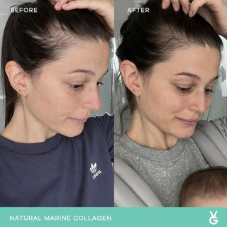 Mixed Natural Marine Collagen Trial Pack – 14 sachets
