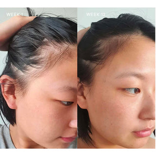 Hairology 30 capsules