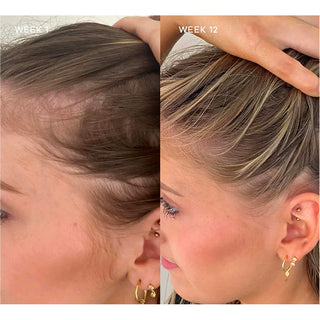 Hairology 30 capsules