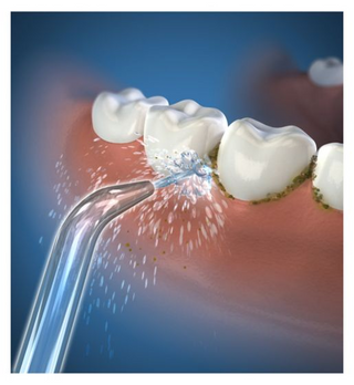 2 Cordless Replacement High Pressure Jet Tips (JT-450E) 2 items