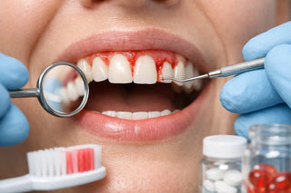 What Causes Bleeding Gums and What Helps?