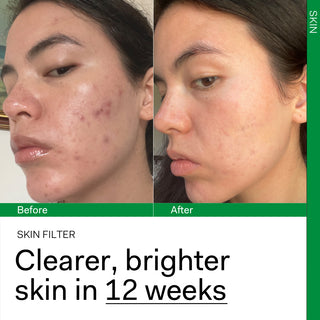 Skin Filter 30 capsules